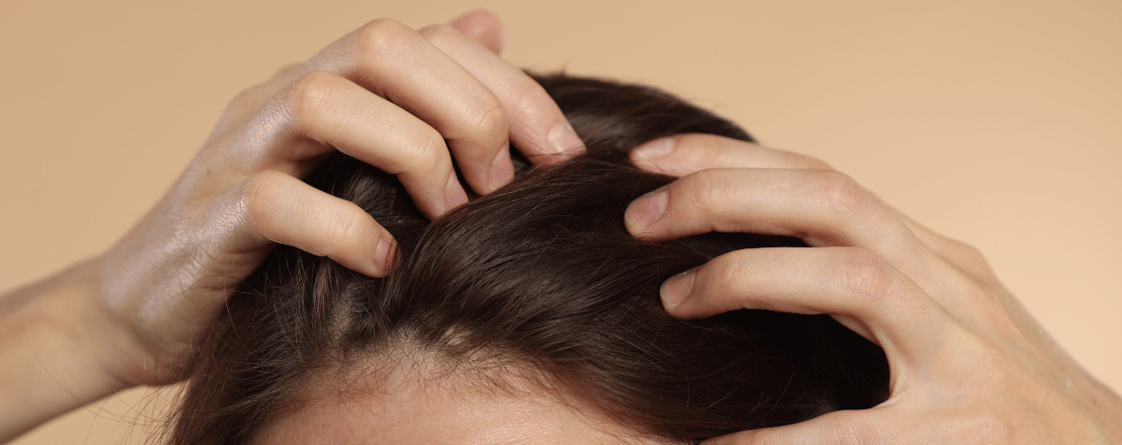 Chute de cheveux : le rôle souvent sous-estimé de la nutrition